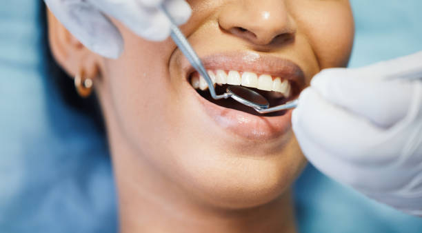 Best Emergency Dentist for Knocked-Out Tooth in Breese, IL