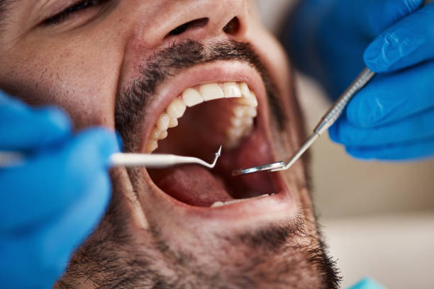 Best Broken or Cracked Tooth Emergency Dentist in Breese, IL
